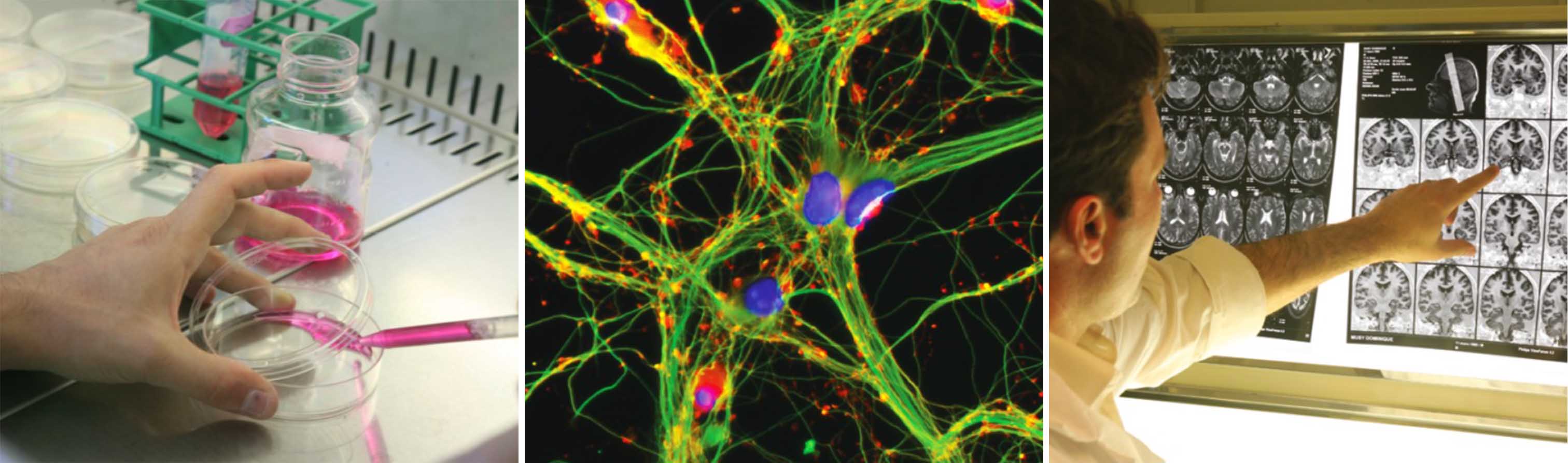 parcours neuro illustration